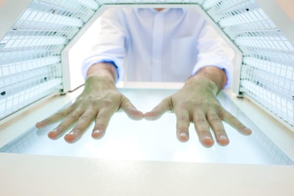 Витилиго: народное лечение, причины, симптомы 6