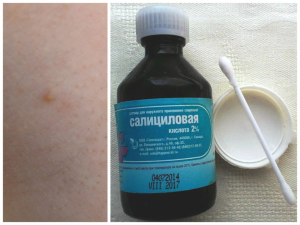 Применение салициловой кислоты от бородавок 2
