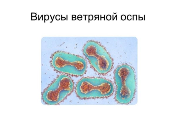 Диарея при ветрянке у детей: когда возникает диарея