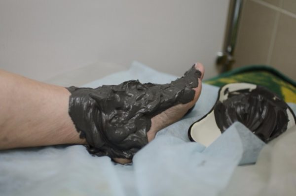 Лечение трофических язв нижних конечностей: препараты на основе таблеток и мазей 8