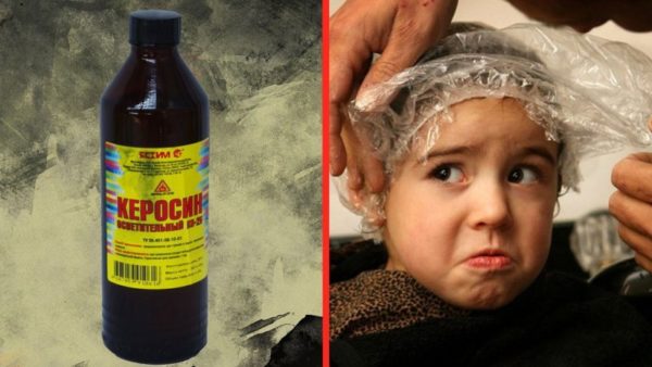 Народные средства от вшей с использованием перекиси водорода, клюквы, керосина, эфирных масел4