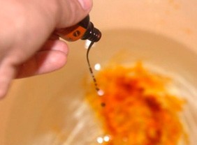 Грибок на ногтях стоп и рук: как выявить заболевание, выделить стадии развития