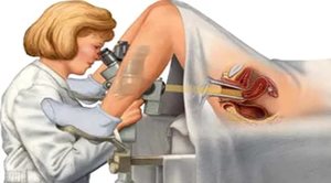 Гинекологический осмотр на 3-й неделе беременности 3 акушерская неделя беременности