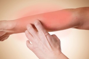 Противогрибковые мази для кожи: обзор самых известных препаратов и дешевых средств