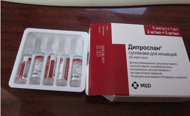 Липоматоз кожи: причины появления, лечение болезни 3