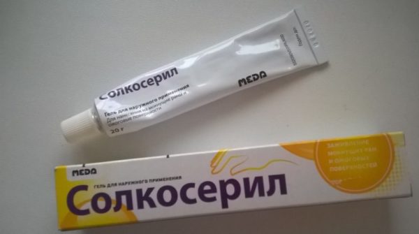 Папиллома в носу: удаление в домашних условиях, меры предосторожности 7