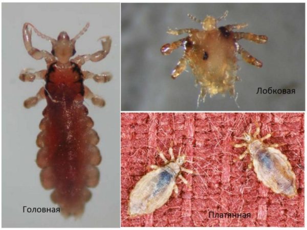 Вши: какие они, прыгают, какие болезни несут1