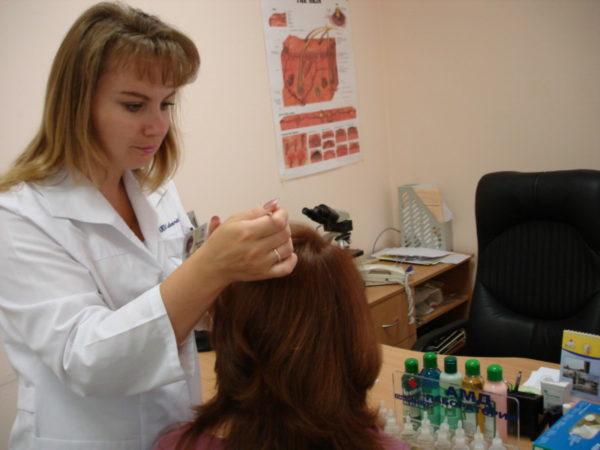 Грибок на голове: как распознать, избавиться от зуда и шелушения