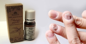 Масло от грибка ногтей: действие, особенности использования натурального противогрибкового средства