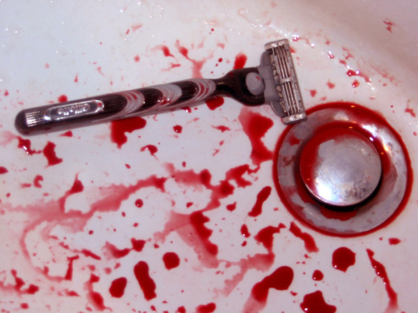 Что делать, если вы разрезали родинку бритвой или острым предметом: как остановить кровотечение, к какому врачу обратиться1