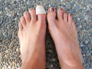 Применение эфирного масла чайного дерева для грибов: полезные свойства, простые рецепты лечения 8