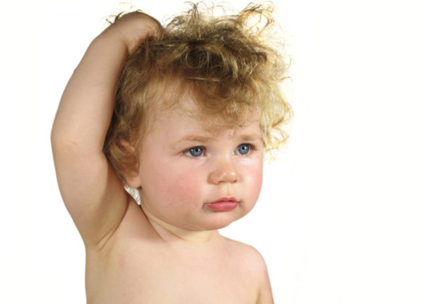 Как понять, что у вас вши, как отличить гниды от перхоти 2