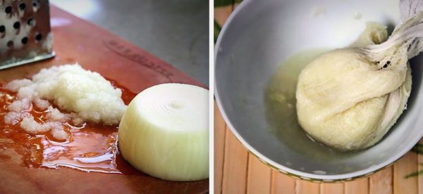 Народные средства от синяков: способствуют сужению сосудов и помогают избавиться от фингала6