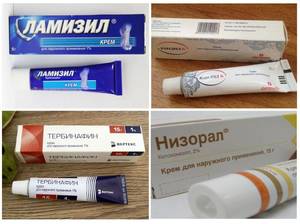 Мазь от грибка стоп: список лучших противогрибковых средств