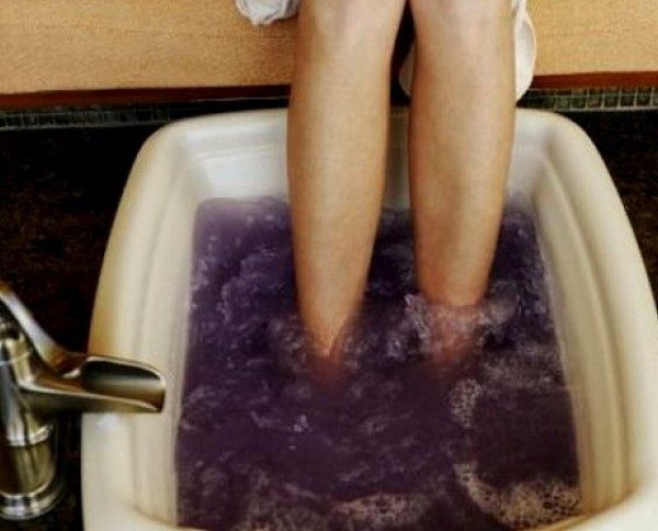 Лечение трофических язв голени при варикозном расширении вен 7