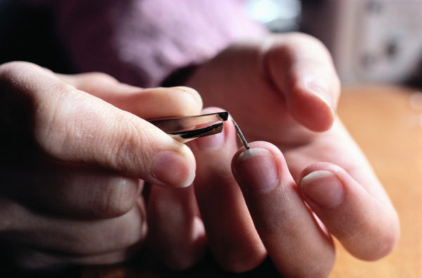 Панариций палец: хирургическое удаление, домашние препараты 1