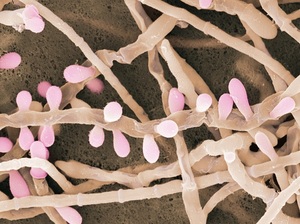 Противогрибковые препараты: дешевые, но эффективные универсальные таблетки и мази1