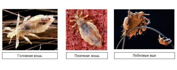 Народные средства от вшей с использованием перекиси водорода, клюквы, керосина, эфирных масел0