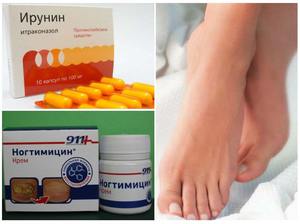 Средство от грибка ногтей: эффективные противогрибковые таблетки и капли, мази и кремы1