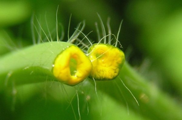 Остиофолликулит: лечение и профилактика стафилококкового импетиго 8