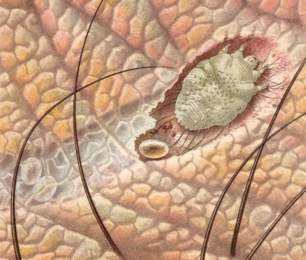 Чесотка: дезинфекция помещения, какие продукты использовать 1