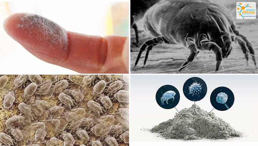 Аллергия на клещей и способы борьбы с ней