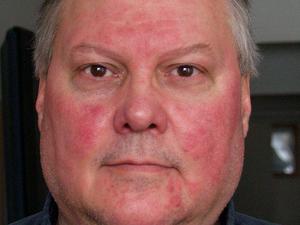 Какое может быть побочное действие Витапроста Возможные побочные эффекты от применения Витапроста