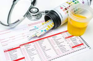 Если у вас плохой анализ мочи Врач при подозрении на высокий уровень ацетона назначит анализ мочи и крови