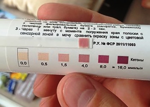 Ацетон в моче у ребенка: как использовать тест Ацетон в моче у ребенка - проверка тест-полоской