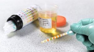 Ацетонурия - особенности заболевания Ацетонурия - это повышенное содержание в организме ацетона