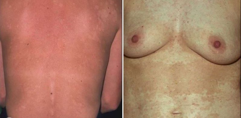 Доместос для дезинфекции квартиры от лишайников у животных и человека 1