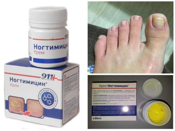 Какой врач лечит грибок ногтей на ногах: выбираем специалиста по онихомикозу