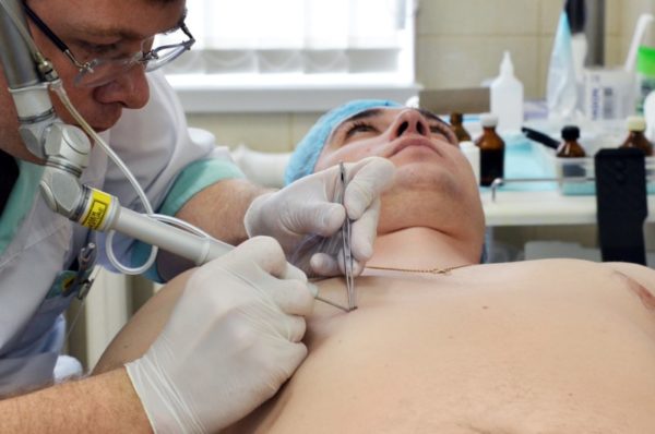 Невус: что это такое, причины образования, виды, симптомы возрождения 15