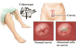 Особенности проведения процедуры Особенности проведения процедуры биопсии