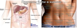 Боли в пояснице и в области живота Почему болит низ живота