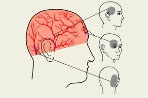 Причины головных болей Почему болит голова