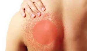 Развитие острого сухого плеврита или плевропневмонии как причина боли под лопаткой Развитие острого сухого плеврита или плевропневмонии как признак боли под лопаткой