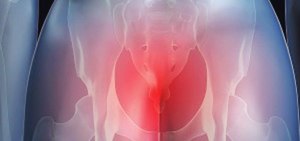 Болит копчик Болит копчик от удара