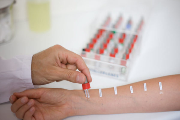 Аллергия на коже: виды, причины, проявления, лечение заболевания 6