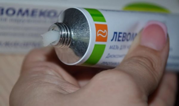 Атерома: лечение в домашних условиях без операции, как распространить опухоль7
