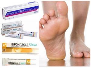 Грибок стопы: симптомы, недорогие препараты для лечения, профилактики