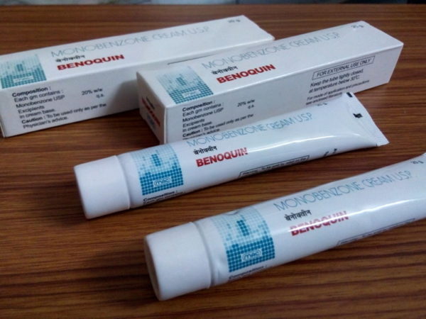 Витилиго: народное лечение, причины, симптомы 4