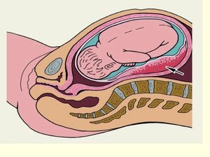 Особенности кровообращения между плодом и матерью Диагностика нарушения маточного плацентарного кровотока