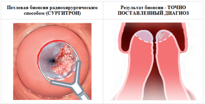 Причины возникновения дисплазии Возможные причины заболевания