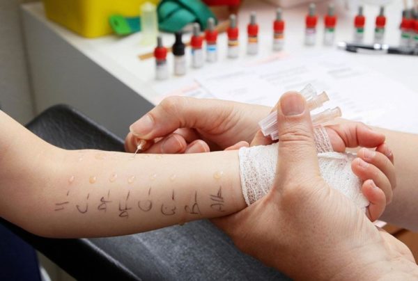 Как средство от кожной аллергии можно использовать мазь для быстрого снятия раздражения и зуда