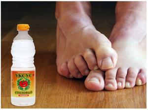 Способы избавления от грибка на ногах народными средствами: рецепты, помогающие в борьбе с недугом