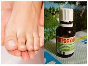 Способы избавления от грибка на ногах народными средствами: рецепты, помогающие в борьбе с недугом