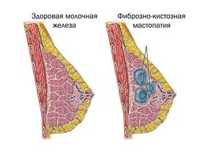 Причины возникновения заболевания Медикаментозное лечение заболевания