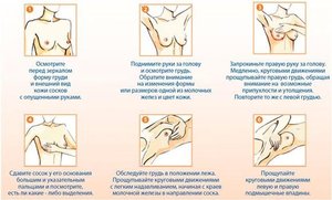 Методы лечение фиброзно-кистозной мастопатии Способы лечения мастопатии