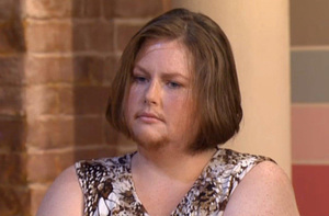 Гиперандрогения у женщин симптомы заболевания Гиперандрогения у женщин - первые признаки